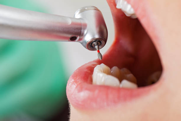 Best Emergency Gum Treatment in Little Cypress, TX